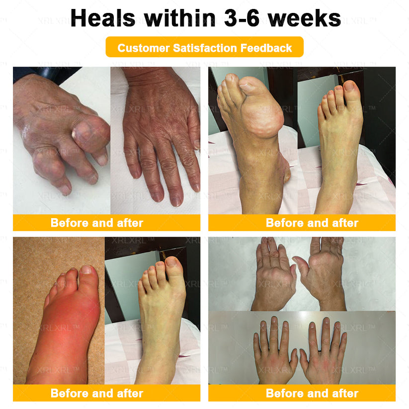 XRLXRL® Bee Venom Pain-Relief Bone Healing Cream 👑👑(Specially for older adults)