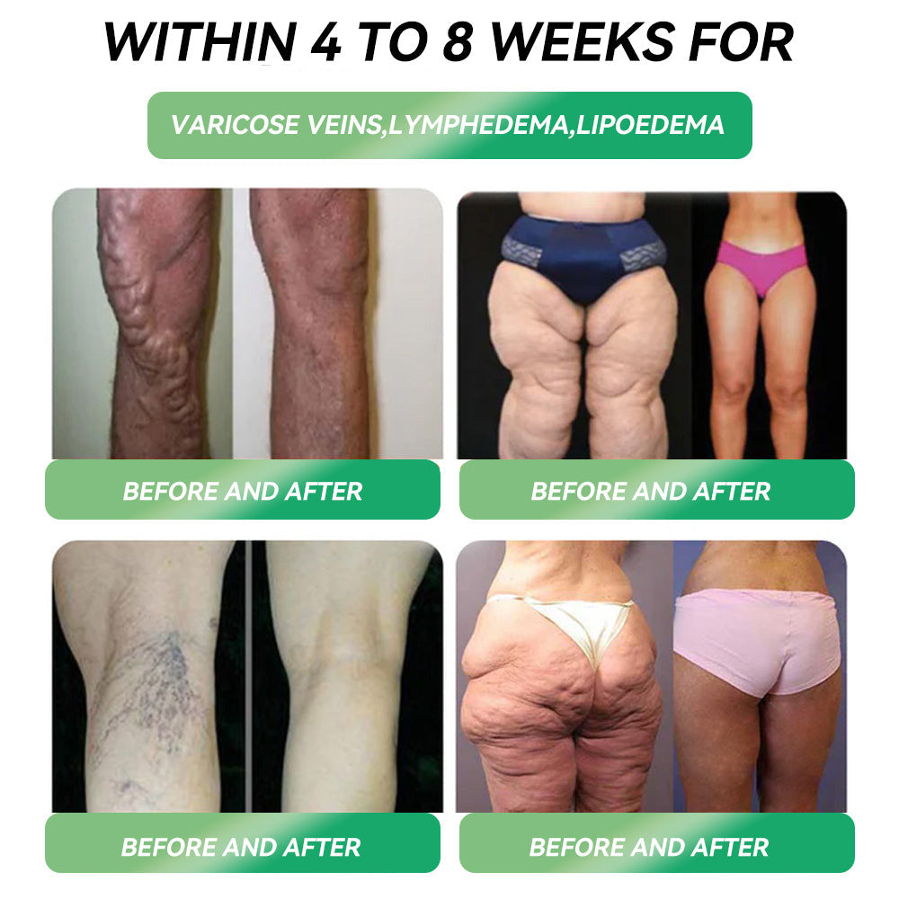 Honxi® NAD+ All Natural Glp-1 Support🌿NAD+ & Moringa & ACV & Keto BHB (✅speedy, long-lasting, addressing diabetes, obesity, and cardiovascular diseases) ✅