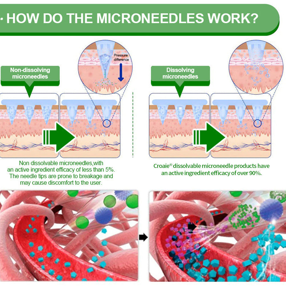 [See results in 7 days]🔔Croaie® Nano Microneedle Patch SMGT-GLP-1 & Matrixyl™  3000（Painless, long-lasting, addressing diabetes, obesity, and cardiovascular diseases）💚
