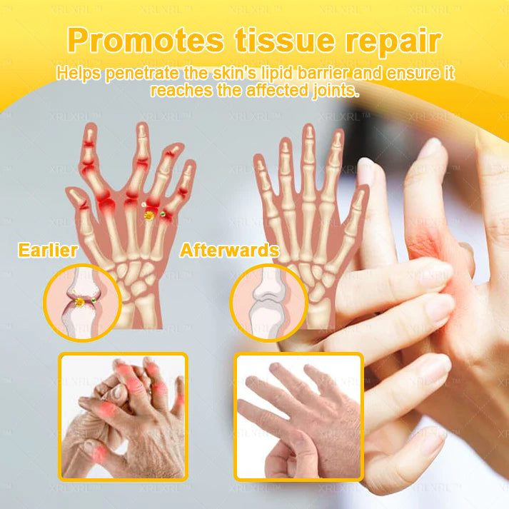 XRLXRL® Bee Venom Pain-Relief Bone Healing Cream 👑👑(Specially for older adults)