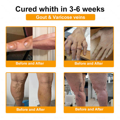 XRLXRL® Bee Venom Pain-Relief Bone Healing Cream 👑👑(Specially for older adults)
