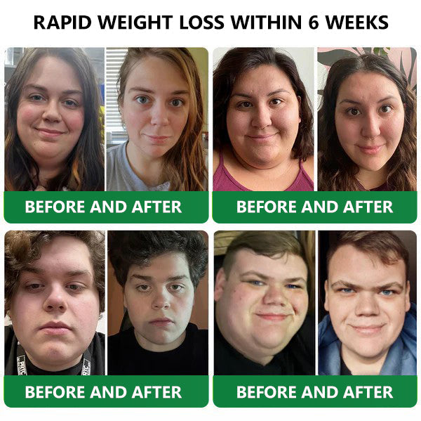 [See results in 7 days]🔔Croaie® Nano Microneedle Patch SMGT-GLP-1 & Matrixyl™  3000（Painless, long-lasting, addressing diabetes, obesity, and cardiovascular diseases）💚