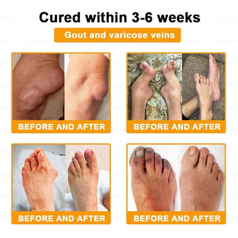 XRLXRL® Bee Venom Pain-Relief Bone Healing Cream 👑👑(Specially for older adults)