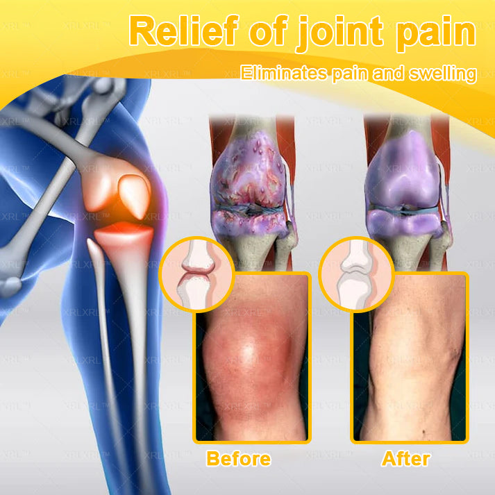 XRLXRL® Bee Venom Pain-Relief Bone Healing Cream 👑👑(Specially for older adults)